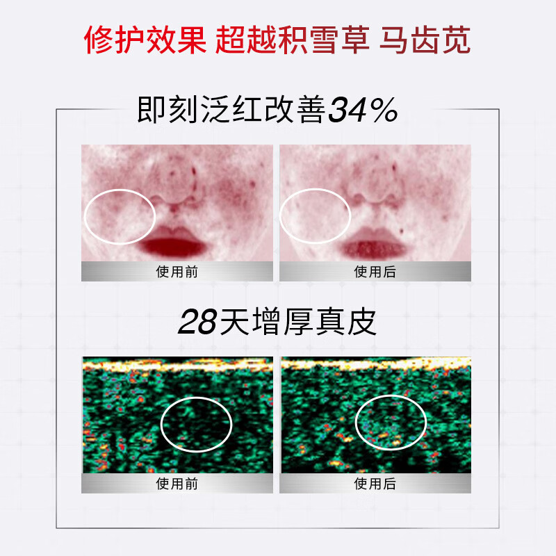 珀芙研舒缓修护次抛精华液30支/盒 修护屏障保湿抗皱紧致男女 【限时钜惠20件】10支屏安精华+冷膜150g