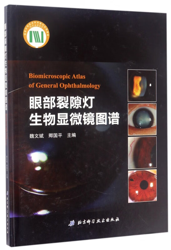 眼部裂隙灯生物显微镜图谱(精)