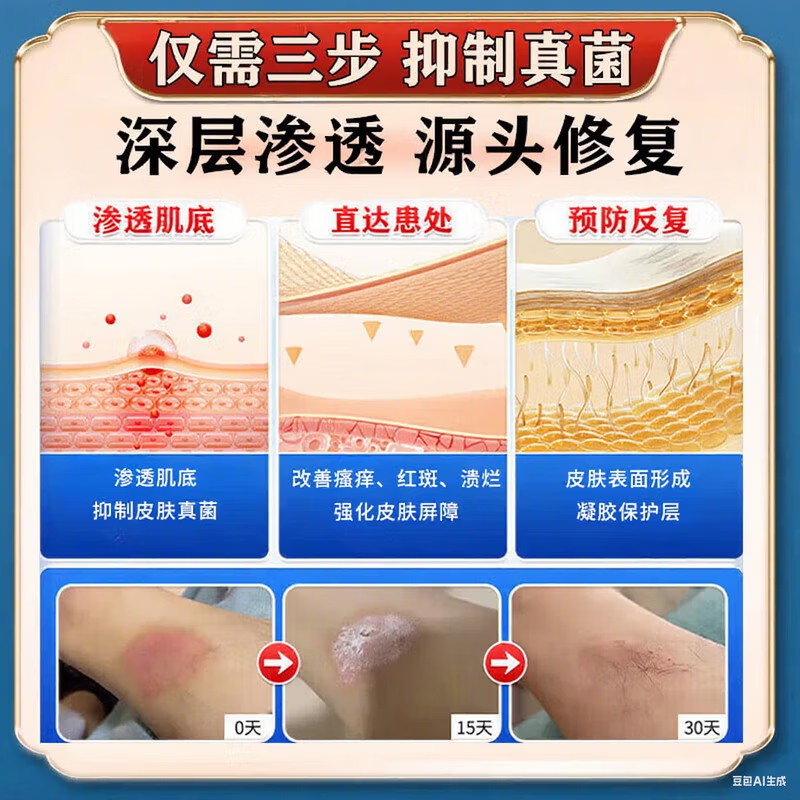 云南本草【云南真菌王】止痒膏皮肤瘙痒皮诊湿痒脚气脚臭脱皮真菌感染 1盒【云南真菌王】试用装