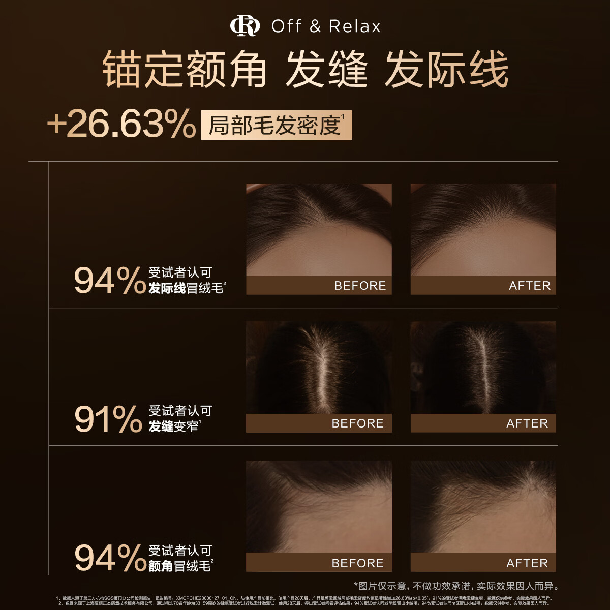 OFF&RELAX防脱育发超活喷雾100ml or头皮精华固发密发防掉发赋活毛囊 【防脱育发】超活喷雾100ml