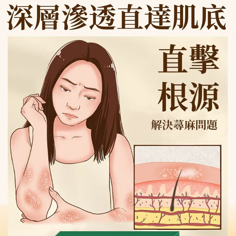 示博士【香港正品】荨麻皂草本肤康肤面部手足全身 男女通用  1盒【日常清洁】贵在运费