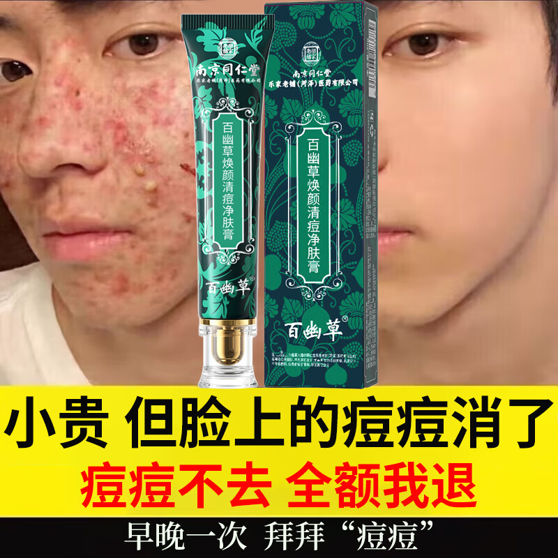 同仁堂祛痘膏去痘痘和痘印痘坑修复男女士改善粉刺闭口30g