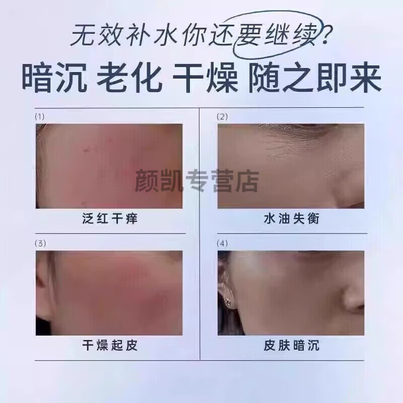 EOKK凝胶ROWY小橙管EOKT皮肤修护膏透明质皮肤祛痘膏祛痘印淡化坑 1盒(轻微症状)