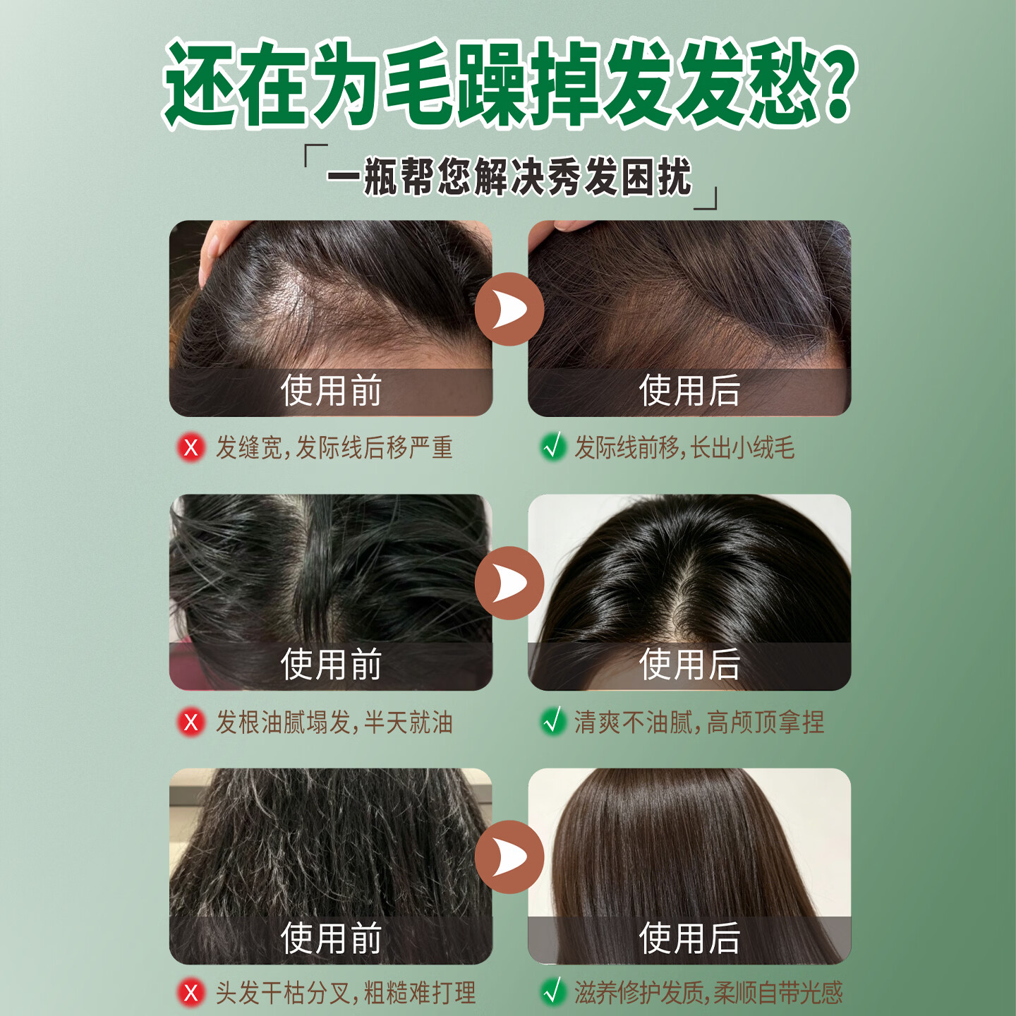 凯丽娜侧柏叶补水保湿精华液滋养发根按摩润养头皮毛囊护理养护液500ml 500ml一瓶