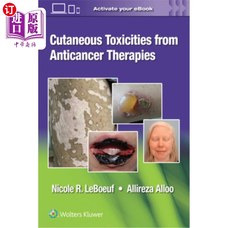 海外直订医药图书cutaneous reactions from anti-cancer therapies