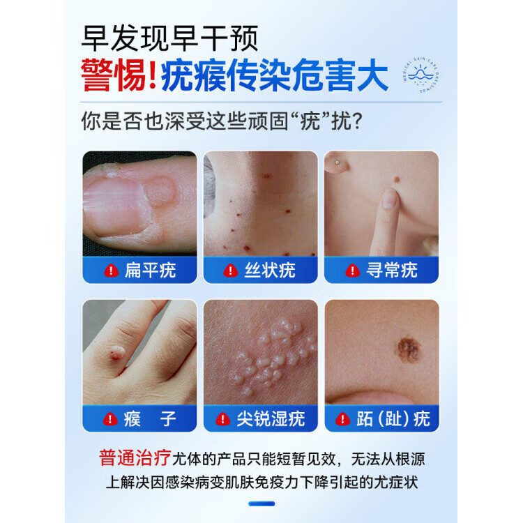 港村制药皮肤护理膏深层克优膏外用保健膏抑菌膏去扁平尤面部涂抹疙瘩肉粒 1支体验装 【品牌直售】