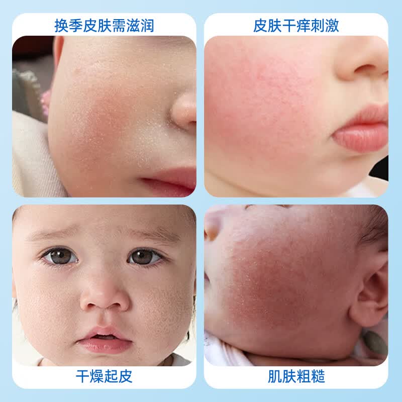 洁悠神婴童抗菌乳宝宝护肤型婴儿身体乳滋润杀菌无刺激护臀全身用