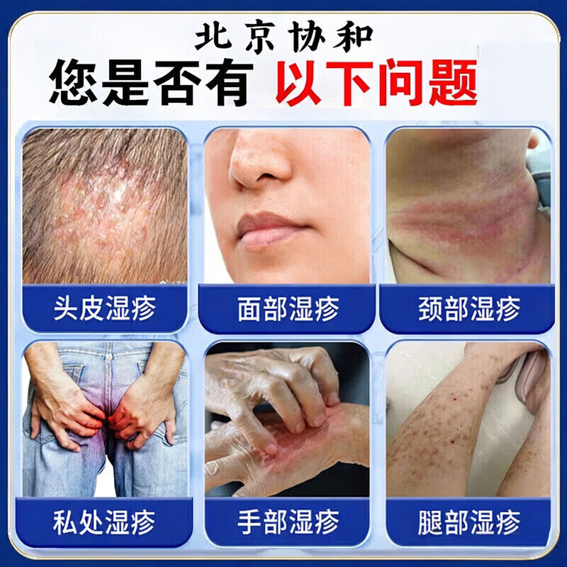 岩井昃弘湿疹膏十大牌子进口湿疹膏止痒抑菌皮肤瘙痒去顽固湿毒真菌感染 特效5盒【此生不再范】日本进口湿疹膏药特效止痒去根 湿疹十大牌子皮肤瘙痒皮炎湿疹