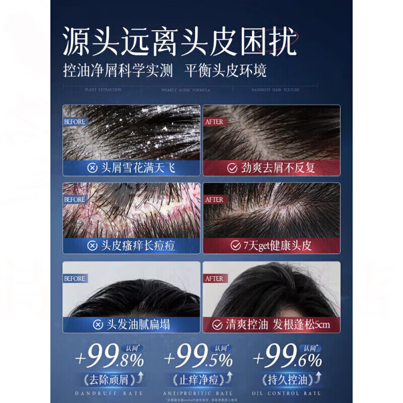 柏璞三重洗发乳改善脂溢性皮炎毛囊炎去头屑控油止痒疏通头皮毛囊舒缓 1瓶【体验装】 【品牌直售】