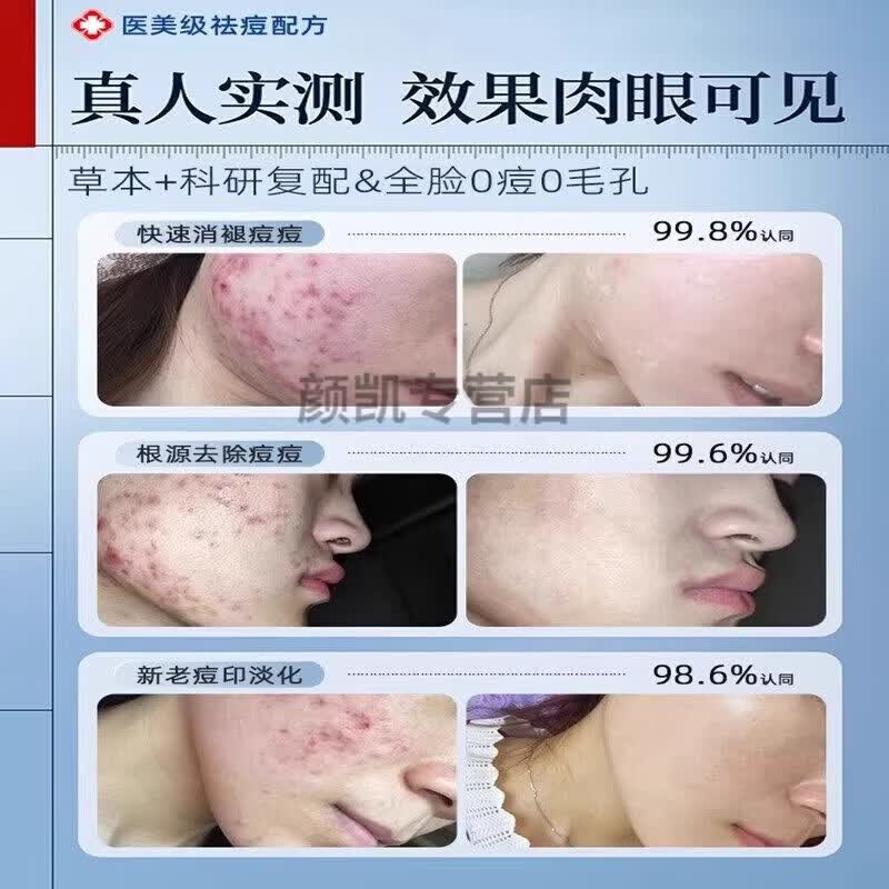 EOKK凝胶ROWY小橙管EOKT皮肤修护膏透明质皮肤祛痘膏祛痘印淡化坑 1盒(轻微症状)