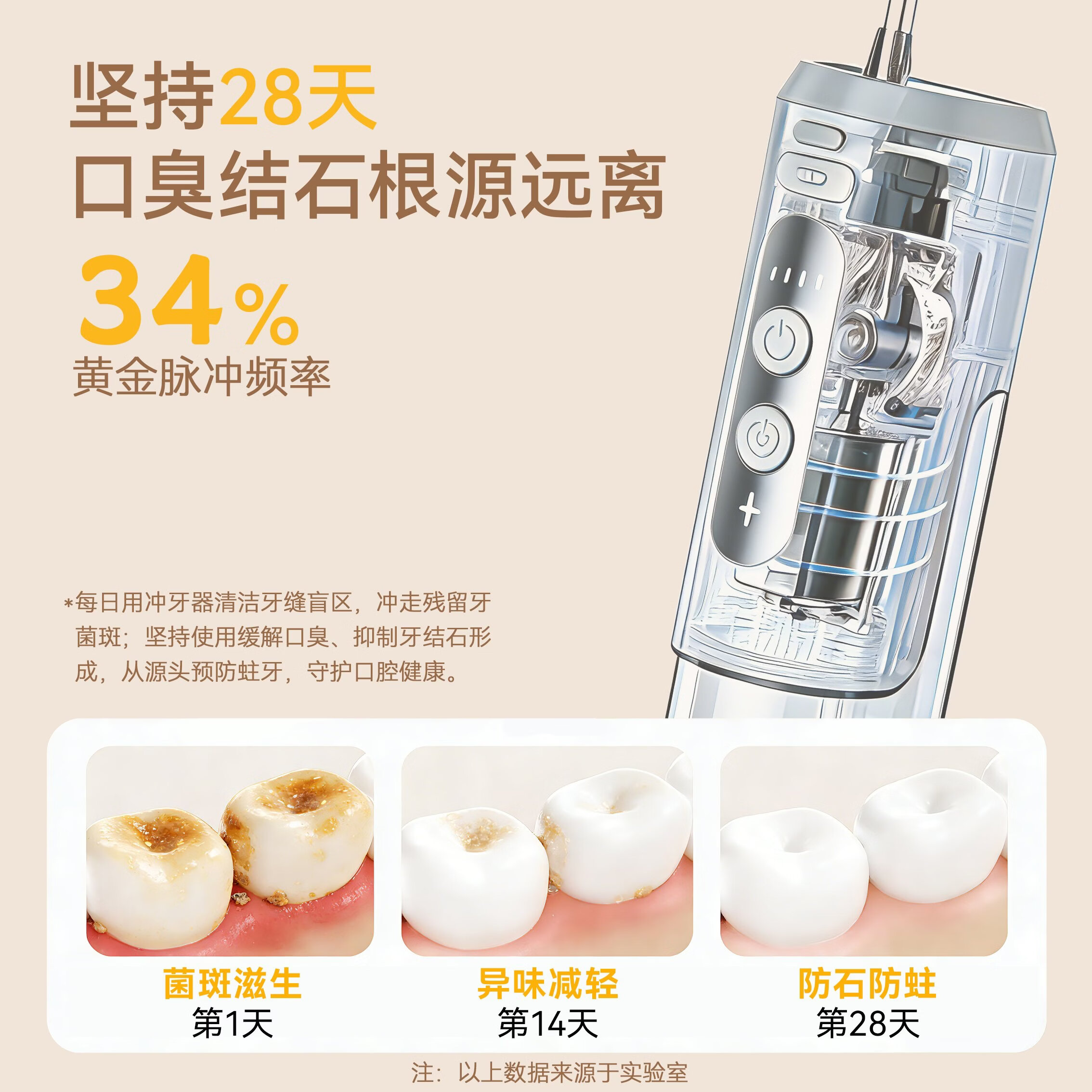 花絮青少年学生适用正畸电动冲牙器洗牙器便携式电动牙齿清洁冲洗正畸牙缝清洁器 曼波绿 4支喷头 青少年专享+评价送4支正畸喷嘴