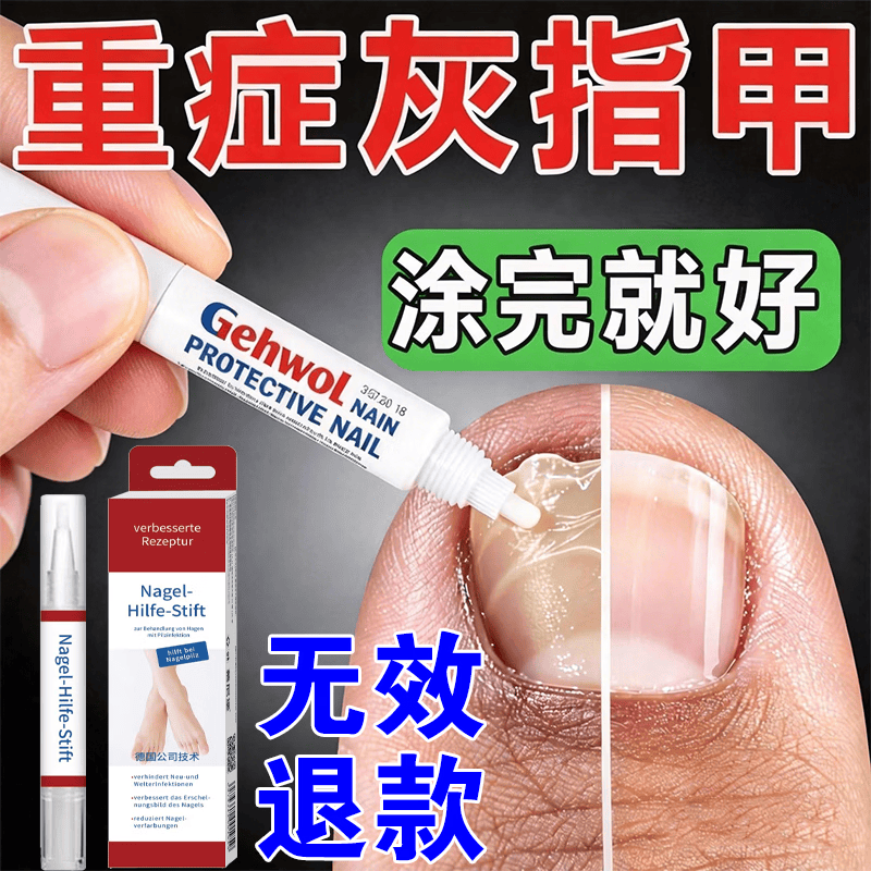 【强韧修护】灰甲笔专用修护液指甲笔专用无痛修复手足指甲护理 3支装【店长力荐重度适用】