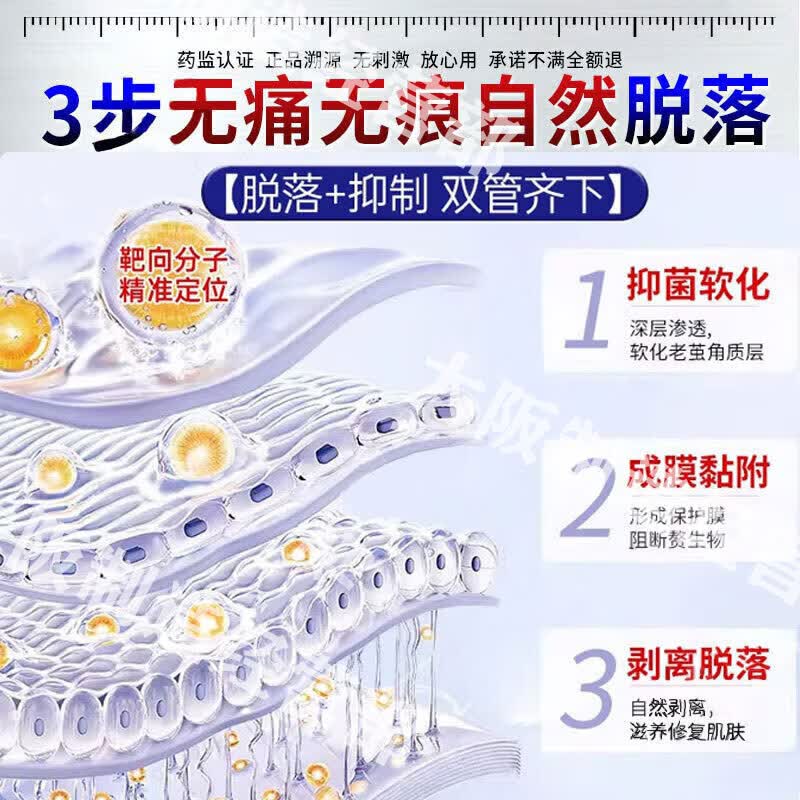 茧立净去老茧子脚茧厚茧去鸡眼脚底脚后跟硬皮去除去i根软化膏 特效买二送一【200%包脱落】 鸡眼膏老茧去除液