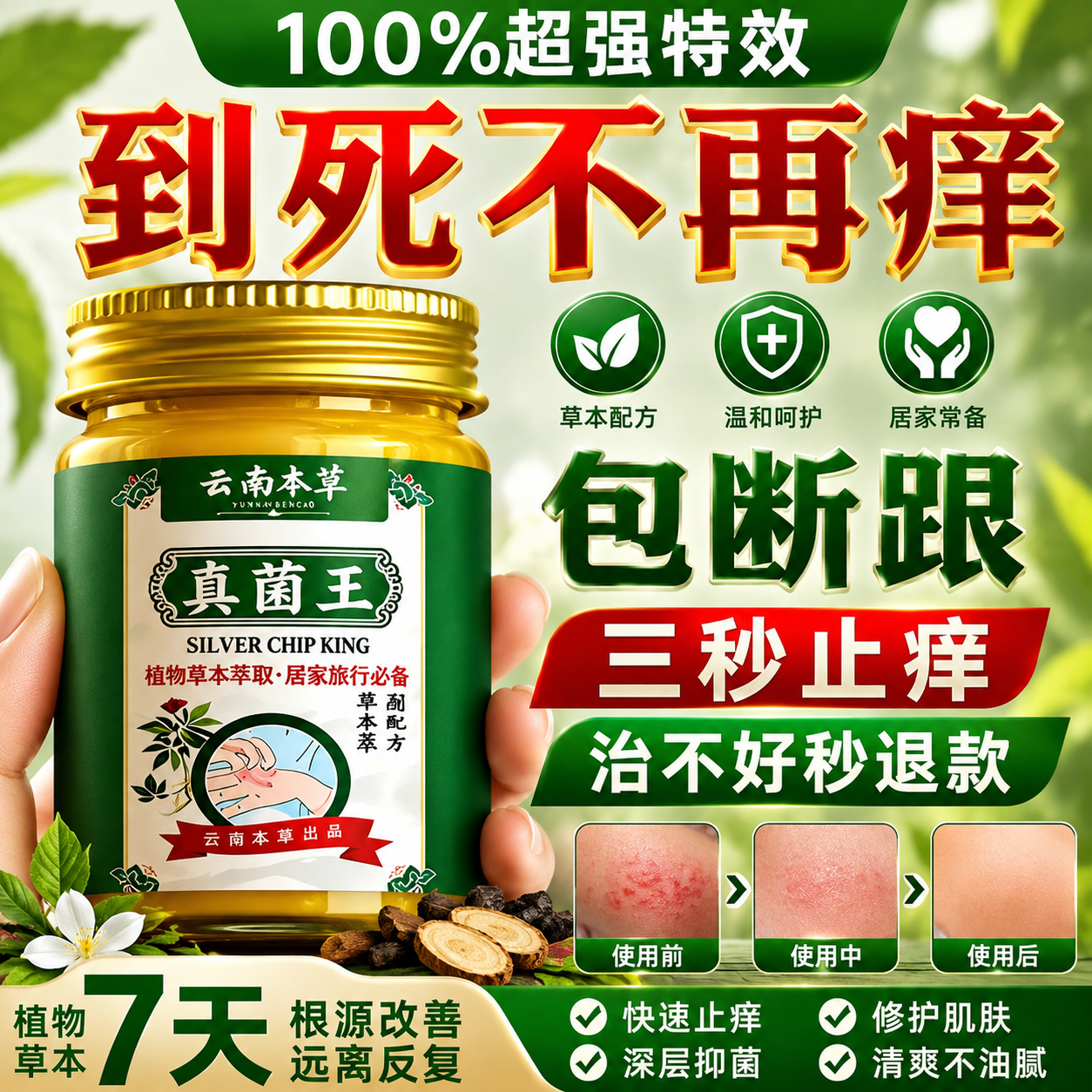 云南本草【香港真菌王】手足全身皮肤外用烂气脚止脱痒皮开裂克星草本乳膏 买一发三【到手3罐】囤货装