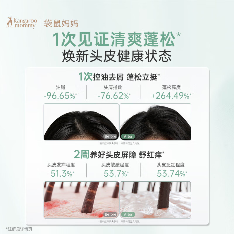 袋鼠妈妈备孕妇女洗护套装洗发水沐浴露小麦柔顺控油保湿蓬松止痒洗沐用品 【全家洗护】控油蓬松洗护3件套+牙膏2支