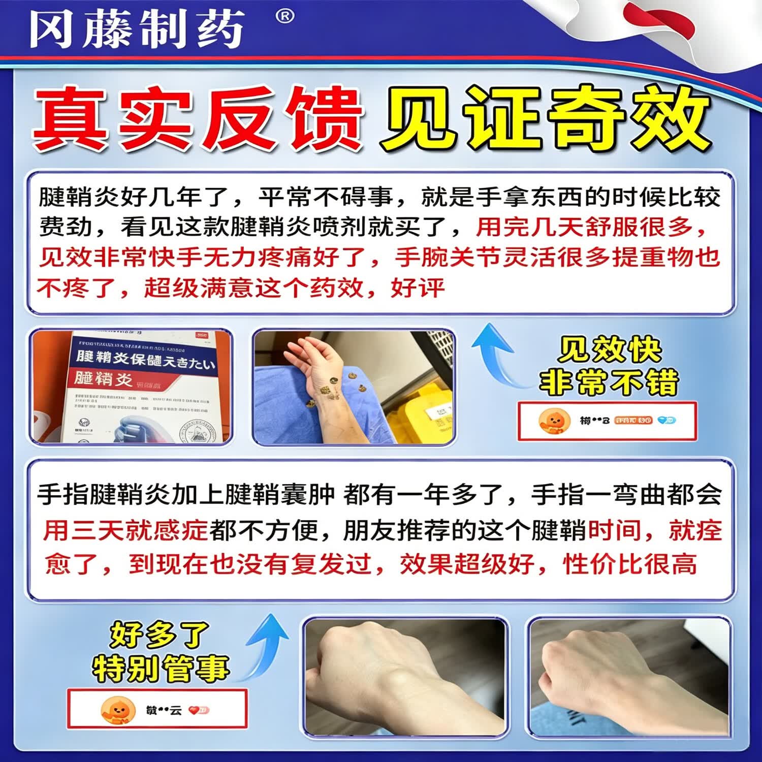 凯迪乐腱鞘炎凝胶专用膏药腱鞘炎贴大拇指手指关节疼痛手指喷剂热敷贴膏 特效一盒【日本进口】 1盒*30g 锦中医远红外骨痛贴腱鞘炎