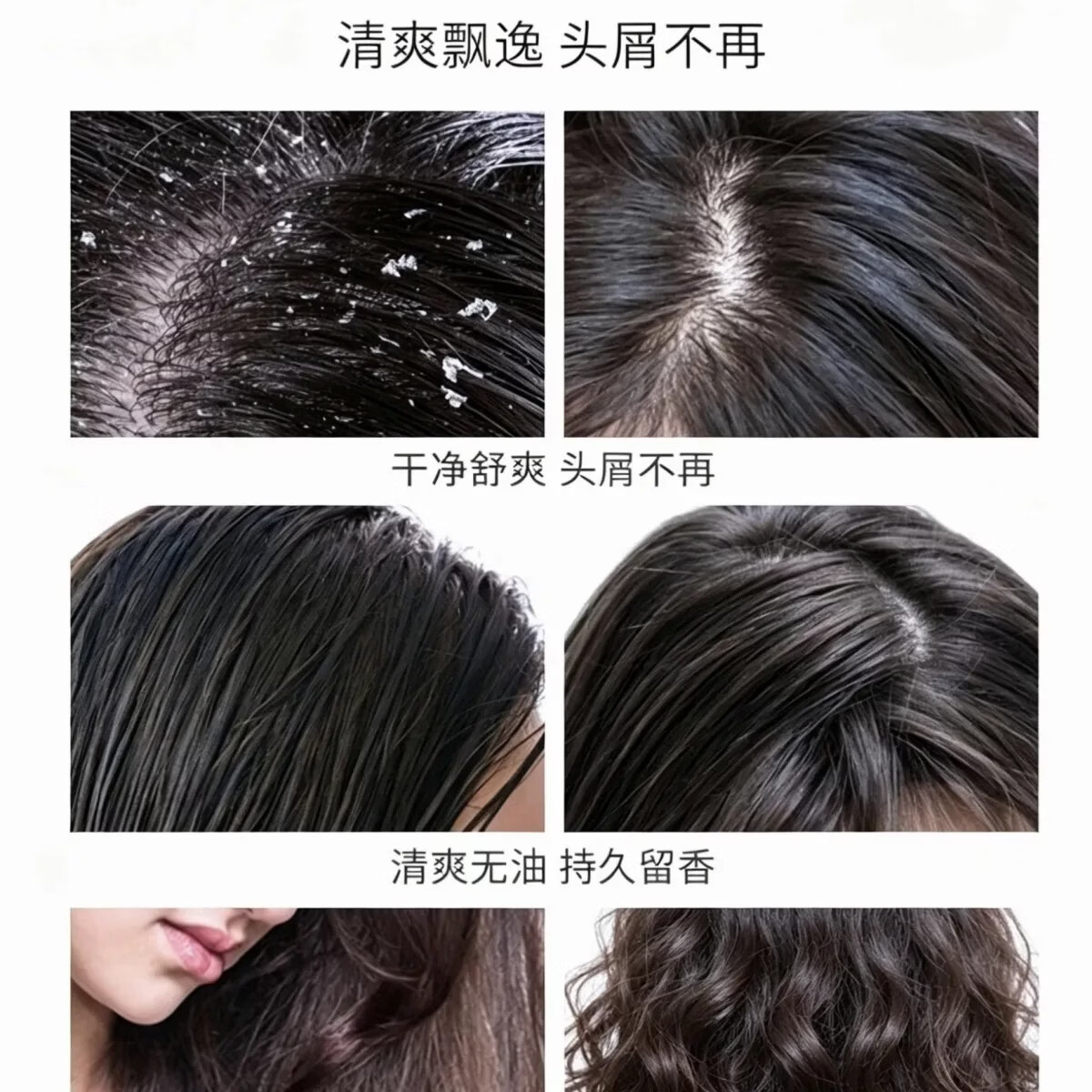C7二硫化硒去屑洗发露 控油止痒改善头屑 清爽头皮男女家用洗发水 一瓶300g