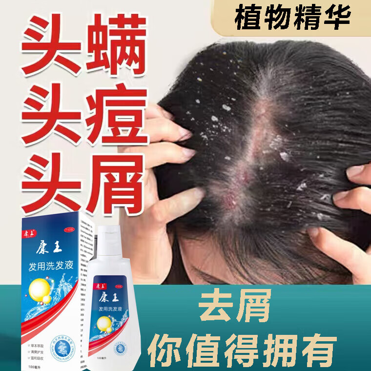 康王洗发i水去屑止痒皮炎毛囊炎脂溢性皮炎湿疹皮癣真菌感染 1盒 体验装