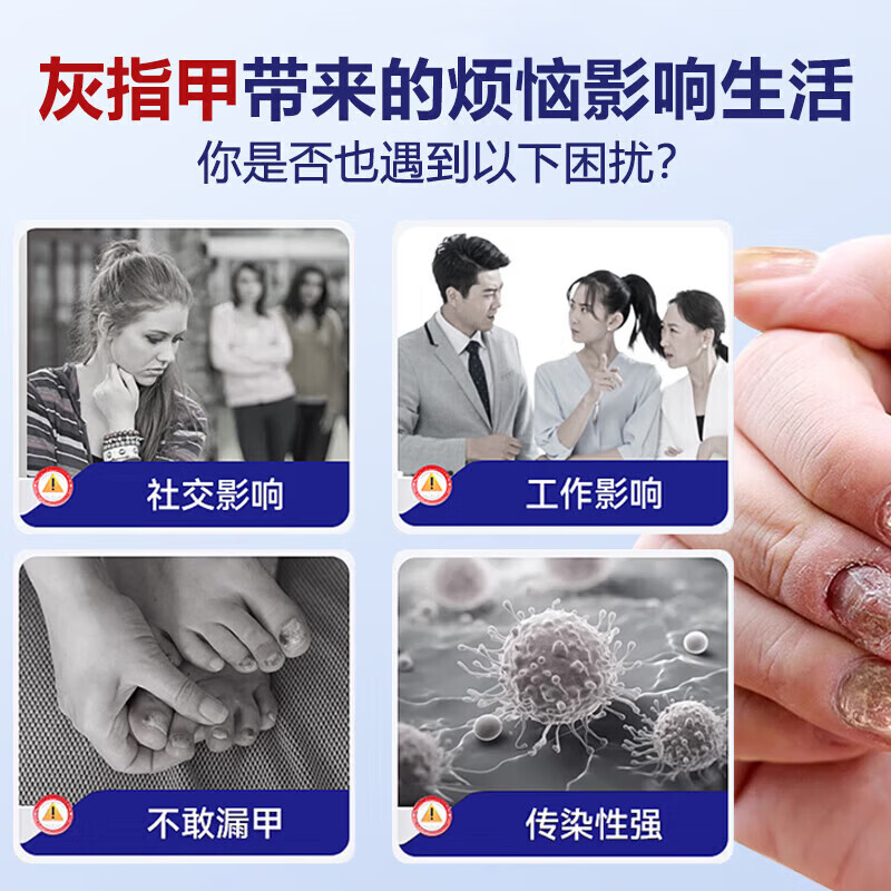 重度灰指甲100%特效专用的药特殊效专用抑菌液灰甲净套装 1盒【特效套装】1-2个灰甲选 灰指甲100%特效专用的药第一名