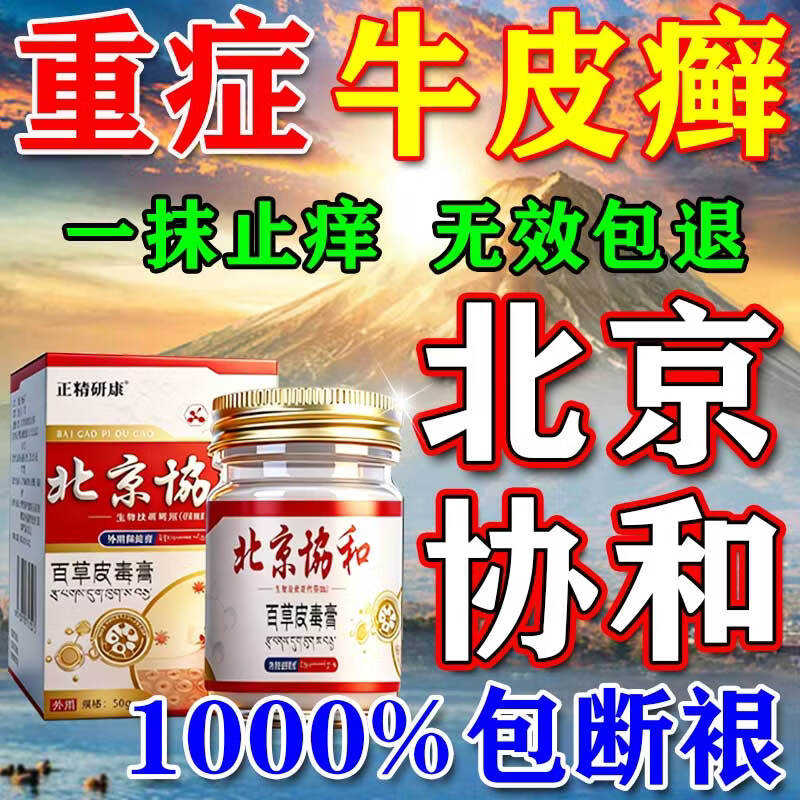 北京协和医学院牛皮癣断根药皮肤癣膏药真菌止痒抑菌皮肤顽固牛皮癣i药膏进口 特强效一盒【牛皮癣克星】 银屑病牛皮癣皮肤癣专用特强效膏