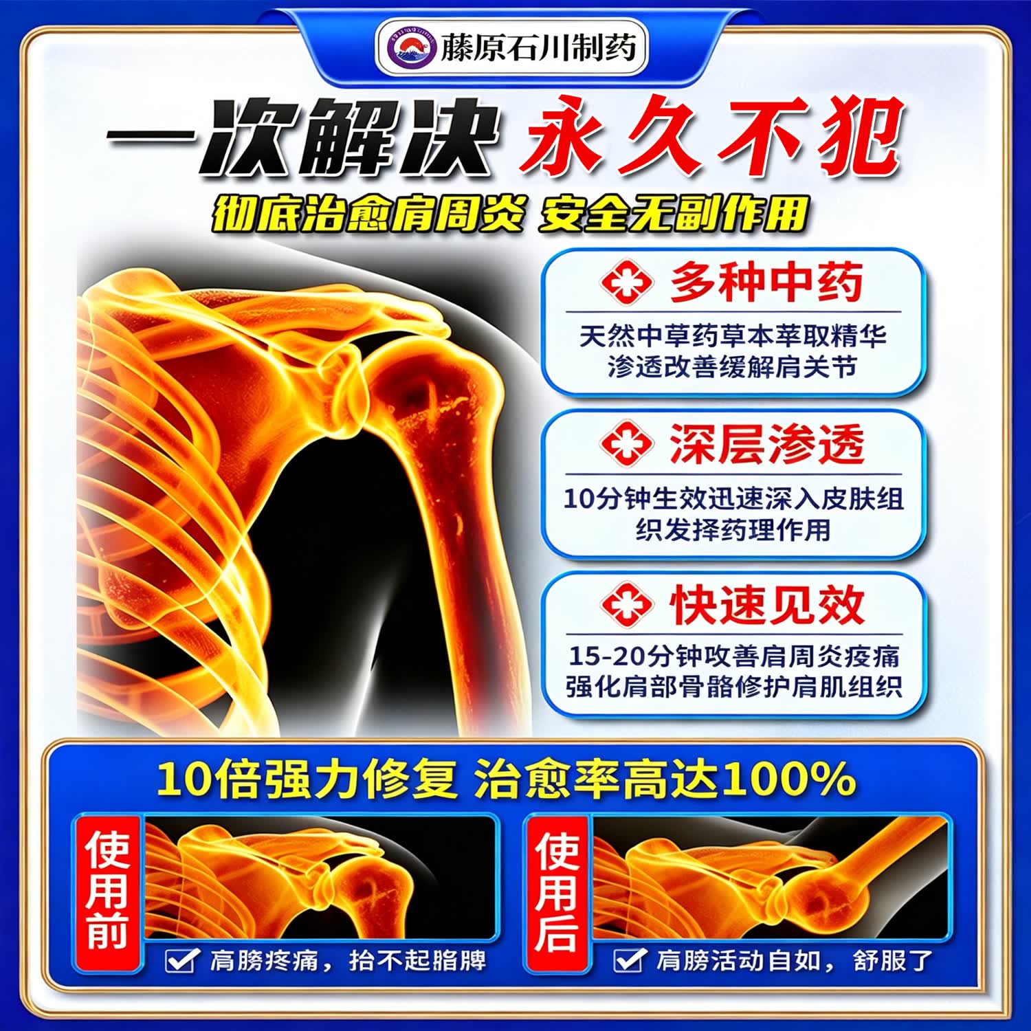 藤原石川制薬肩周贴膏肩膀疼痛胳膊抬不起来专用肩周劳损胳膊肩周炎专用贴膏药 特效买3送2【200%患者痊愈】 胳膊僵硬严重肩周炎专用热敷贴膏