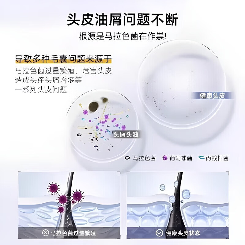 FIXI日本品牌洗发水去屑止痒控油持久蓬松二硫化硒男士持久留香柔顺女 [干枯毛躁选]柔顺香氛洗发水 5瓶装[囤货钜惠装]超控油真去屑