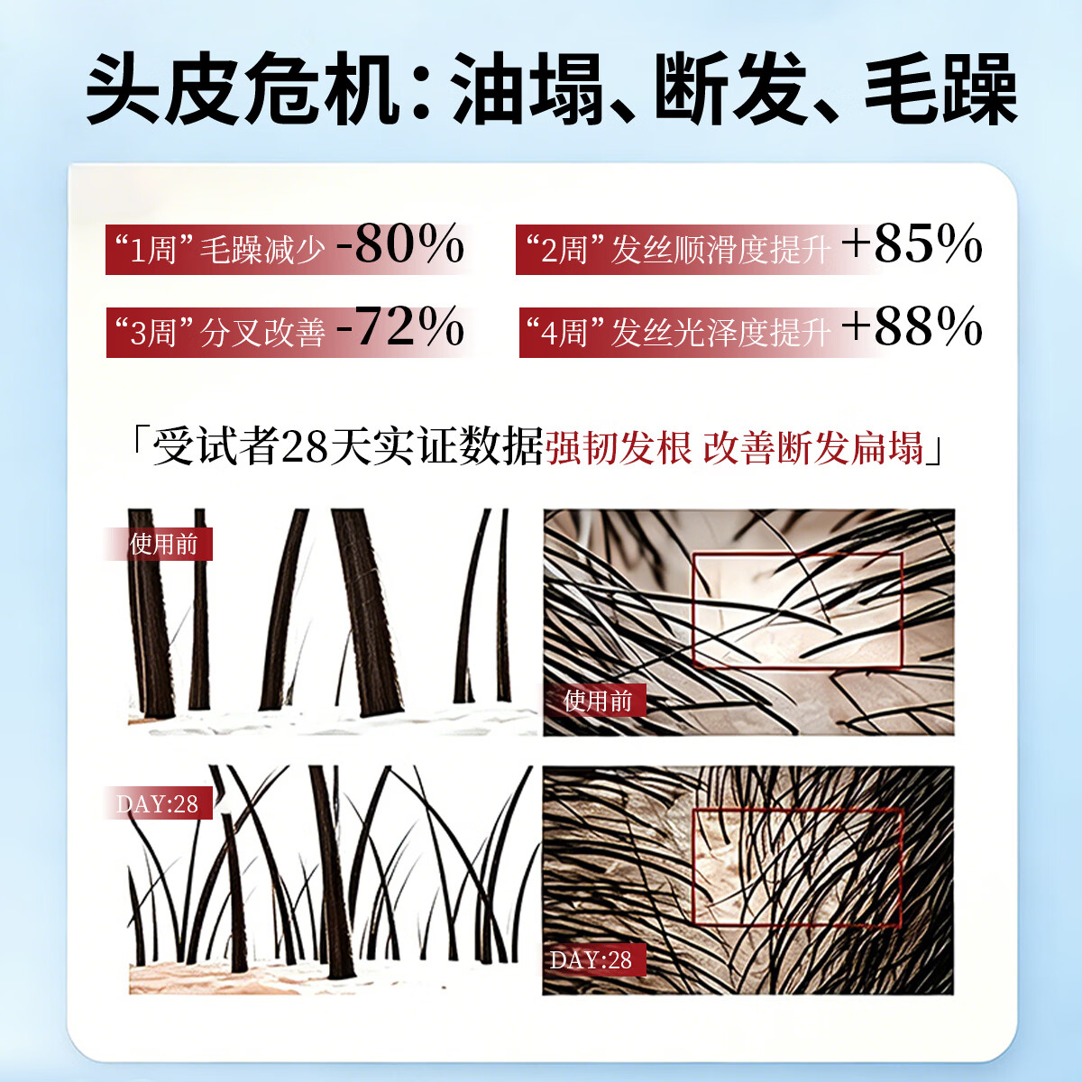 莉米洛LIMILUO第二代米洛地尔男士头皮养发液滋养发丝减少掉发断发 【三瓶】男士头皮养发液