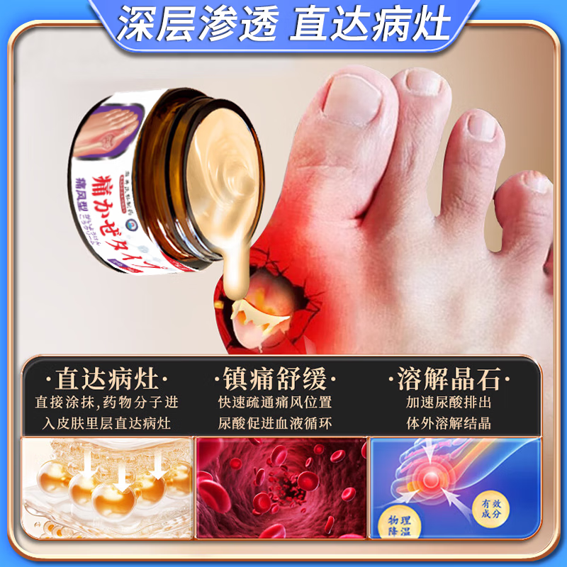 岩井昃弘痛风结晶溶解药去除痛风石膏药贴降i尿酸消肿止痛尿酸高关节疼痛 特效3盒膏【200%治根】日本进口 特效新i版专用膏强力结晶进口