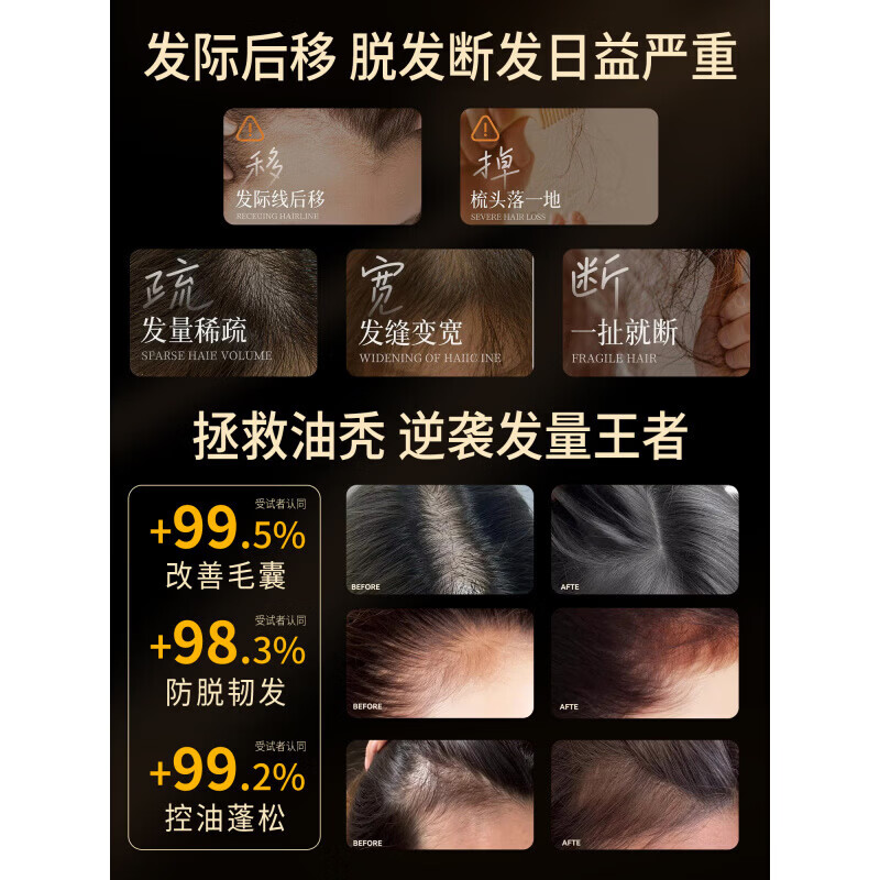 南京同仁堂防脱密发液固发增发剂快速生长发侧柏叶生姜营养毛囊焕活头皮精华 买2送1【强韧发根不脱】梳头不掉发 102ml