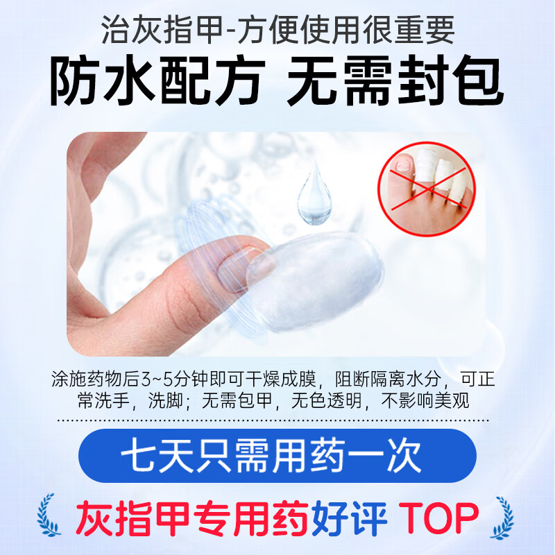 楚甲盐酸阿莫罗芬搽剂1.5ml国药准字治疗灰指甲专用药正品真菌感染皮肤用药抑菌阿莫罗芬搽剂正品旗