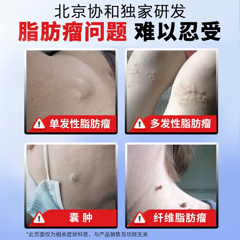 云南本草脂肪康脂肪瘤专用膏药去除神器消除硬块鼓包脂肪消散膏皮下囊肿 5盒【绝不复发】拍3发5 陈九玄脂肪瘤膏皮下多发性鼓包