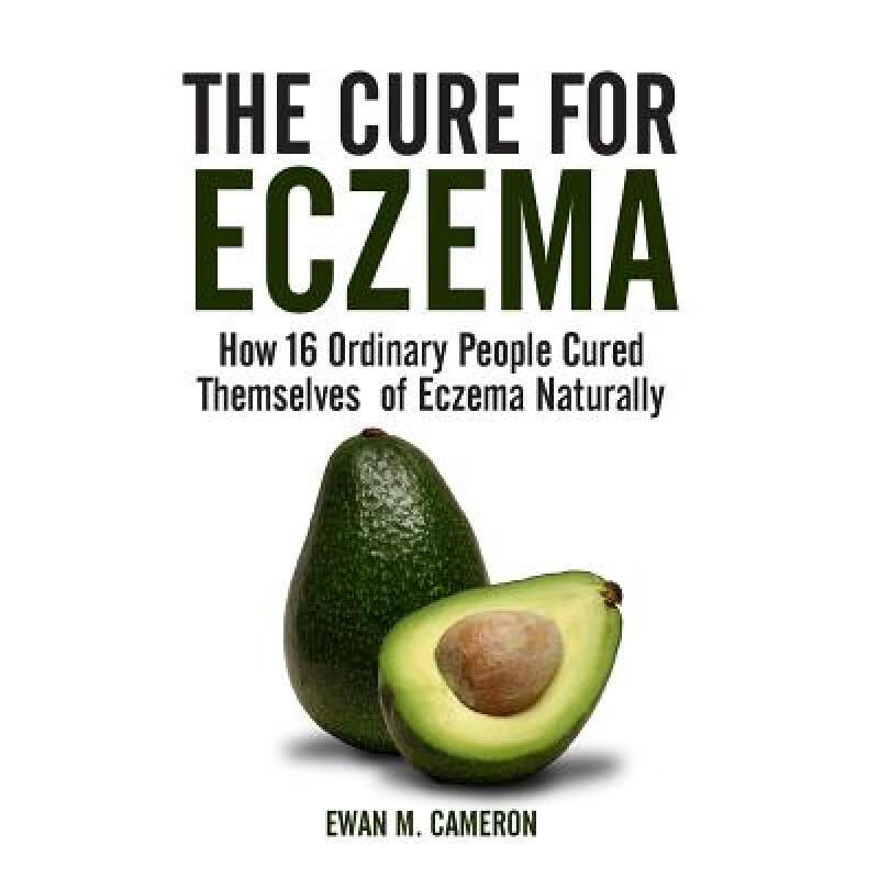 预订 The Cure for Eczema