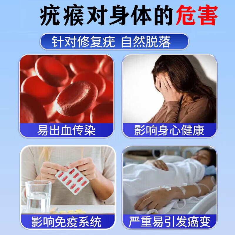 祥醫堂祛疣膏脖子上小肉粒扁平i疣丝状i疣面部药专用脖子克优膏脖子肉粒 升级款软膏【1盒】