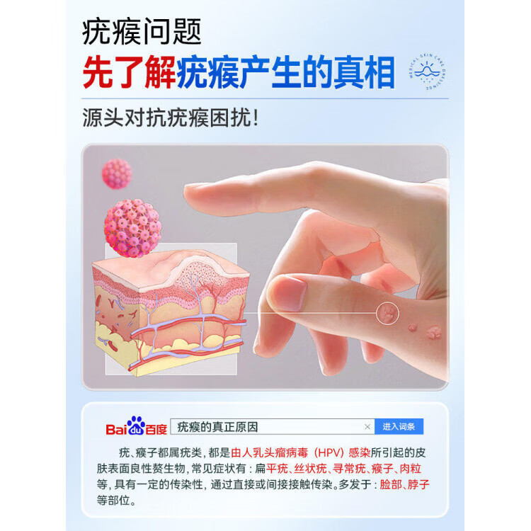 港村制药皮肤护理膏深层克优膏外用保健膏抑菌膏去扁平尤面部涂抹疙瘩肉粒 1支体验装 【品牌直售】