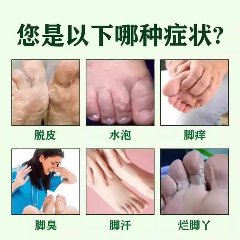 [中国药材（SINO-TCM）]足光散 20g*3袋 5盒装 泡脚止痒脱皮足光粉 清热燥湿杀虫敛汗手足癣脚气药 去脚气脚痒 严重脚气 臭味难闻