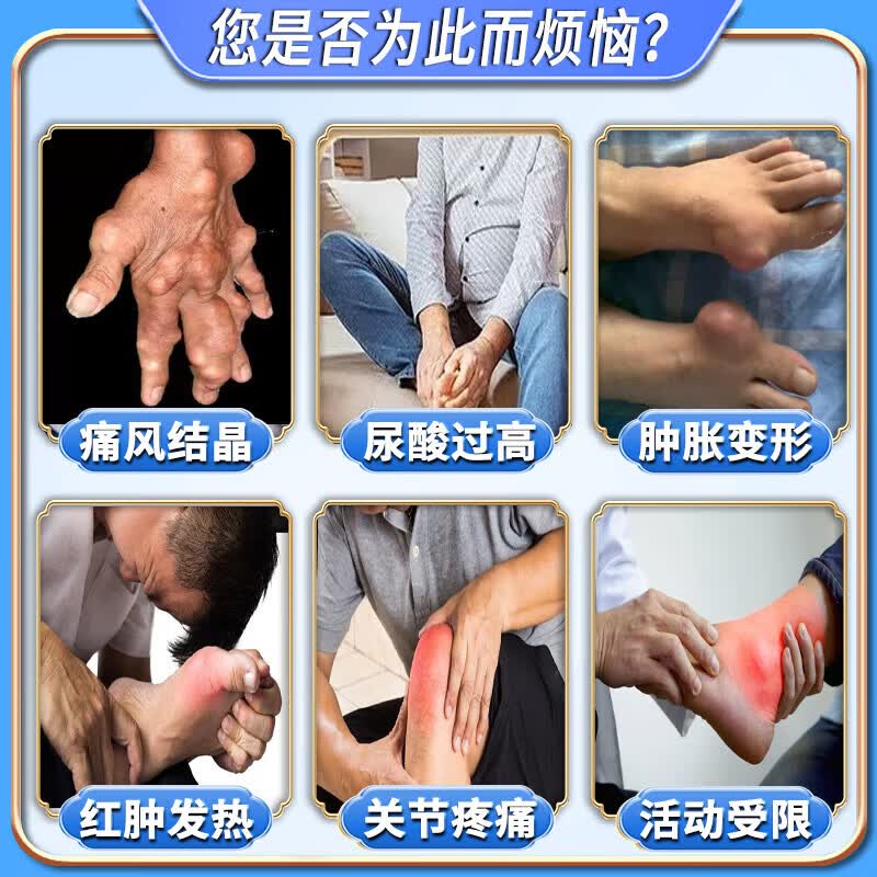 岩井昃弘痛风结晶溶解药去除痛风石膏药贴降i尿酸消肿止痛尿酸高关节疼痛 特效3盒膏【200%治根】日本进口 特效新i版专用膏强力结晶进口