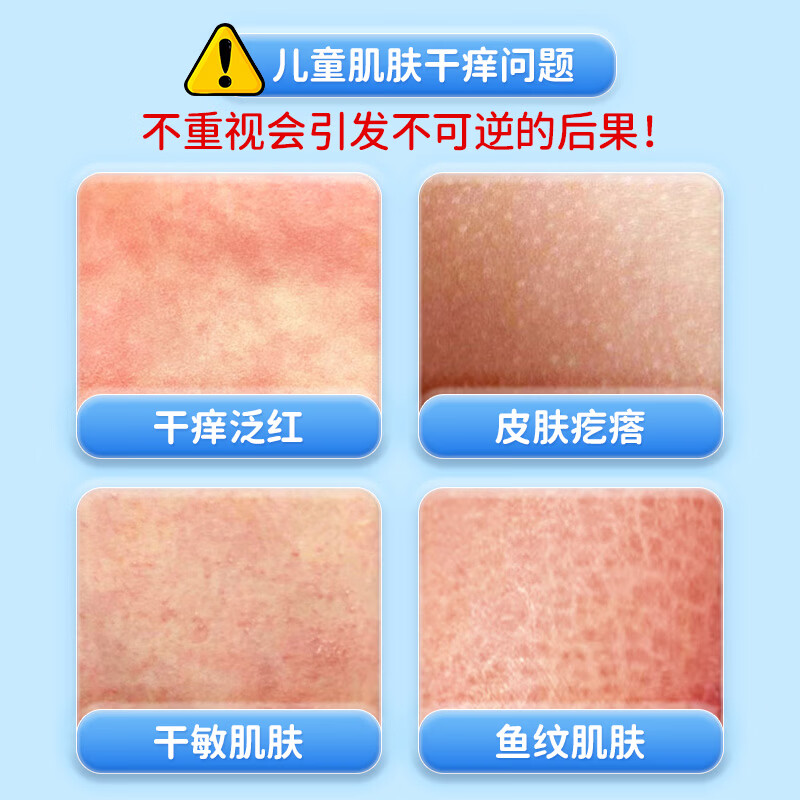 袋鼠杰克儿童凡士林金盏花身体乳宝宝婴幼儿保湿润肤乳滋润大容量全身可用 【滋润肌肤·清爽保湿】儿童身体乳650ml*1瓶