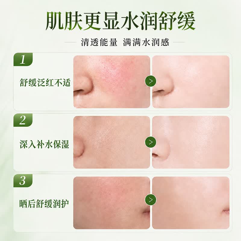 劳丽诗多重芦荟膏补水保湿舒缓凝胶滋润清爽水润改善晒后肌肤泛红男女 晒后舒缓芦荟胶x1瓶.