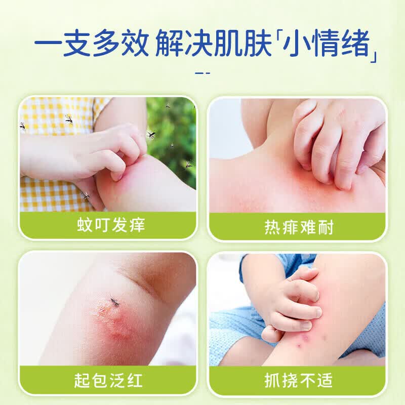 boiron宝弘金盏花止痒膏蚊虫叮咬止痒消肿膏婴幼儿专用宝宝蚊虫叮咬药膏 3盒【500%止痒消肿包】买2送1 宝弘止痒膏儿童蚊虫叮咬金盏花小绿管