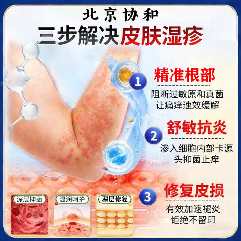 岩井昃弘湿疹膏十大牌子进口湿疹膏止痒抑菌皮肤瘙痒去顽固湿毒真菌感染 特效5盒【此生不再范】日本进口湿疹膏药特效止痒去根 湿疹十大牌子皮肤瘙痒皮炎湿疹