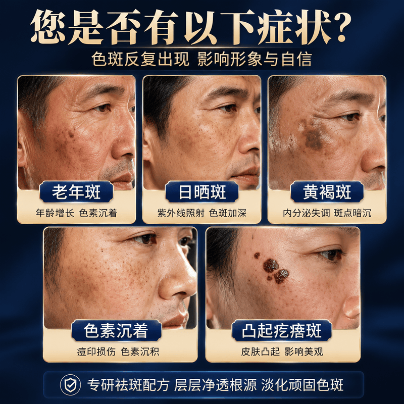 北京协和医学院祛斑霜老年斑专用特效非药一夜消去老年斑男士专用的药脸部手背 特效1盒装【北京协和】祛斑点斑专用的药水医用级 医用美白祛斑霜淡化黑色素去雀斑黄褐斑正品
