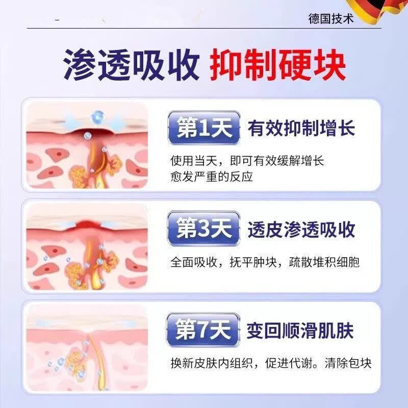 宁仲医脂肪康消膏贴皮下肿硬块专用去除皮脂腺囊肿蓖麻子非神器特效膏 体验装【1盒】20g/支 官方直销 京质保障