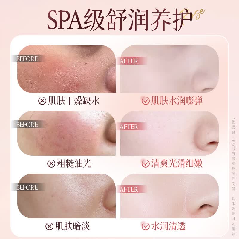 ESCP玫瑰花露补水保湿面膜补水修护肌肤大学生男女补水用 玫瑰面膜*2盒