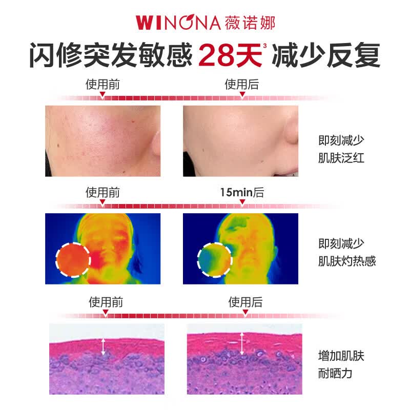 薇诺娜（WINONA）舒敏保湿特护霜面霜舒缓肌肤修护屏障补水护肤品官方正品旗舰 【正替组合】特护霜50g