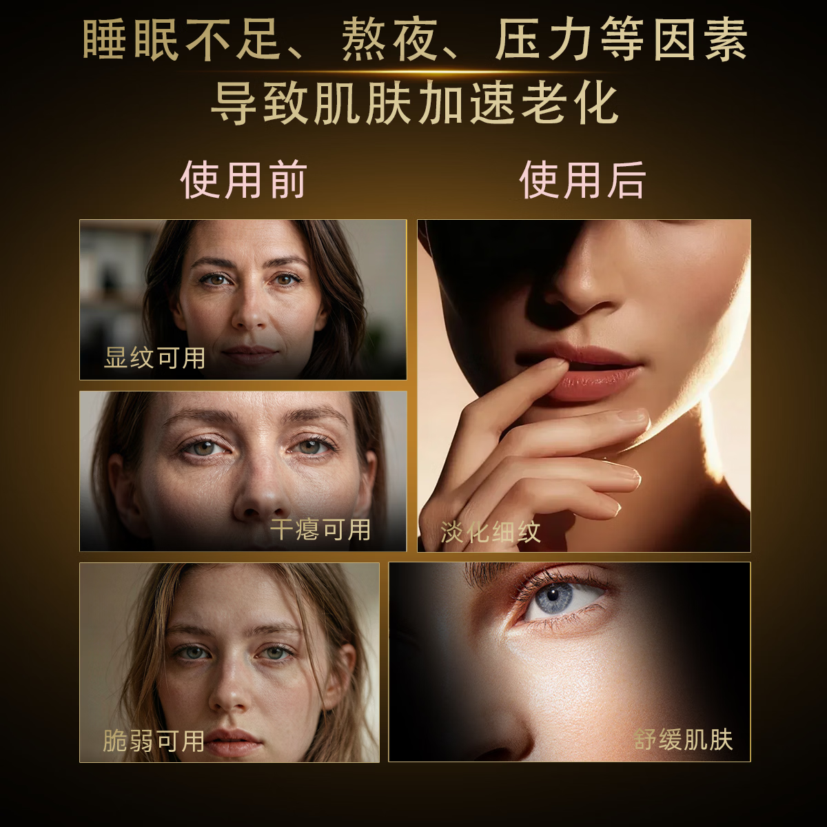 MISTY DAY二裂酵母保湿补水抗皱紧致舒缓水润护肤套装 乳液