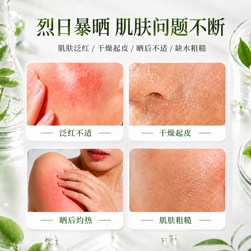 劳丽诗多重芦荟膏补水保湿舒缓凝胶滋润清爽水润改善晒后肌肤泛红男女 晒后舒缓芦荟胶x1瓶.