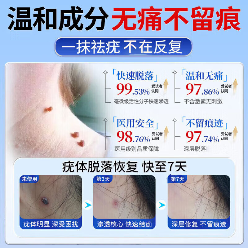 祥醫堂祛疣膏脖子上小肉粒扁平i疣丝状i疣面部药专用脖子克优膏脖子肉粒 升级款软膏【1盒】