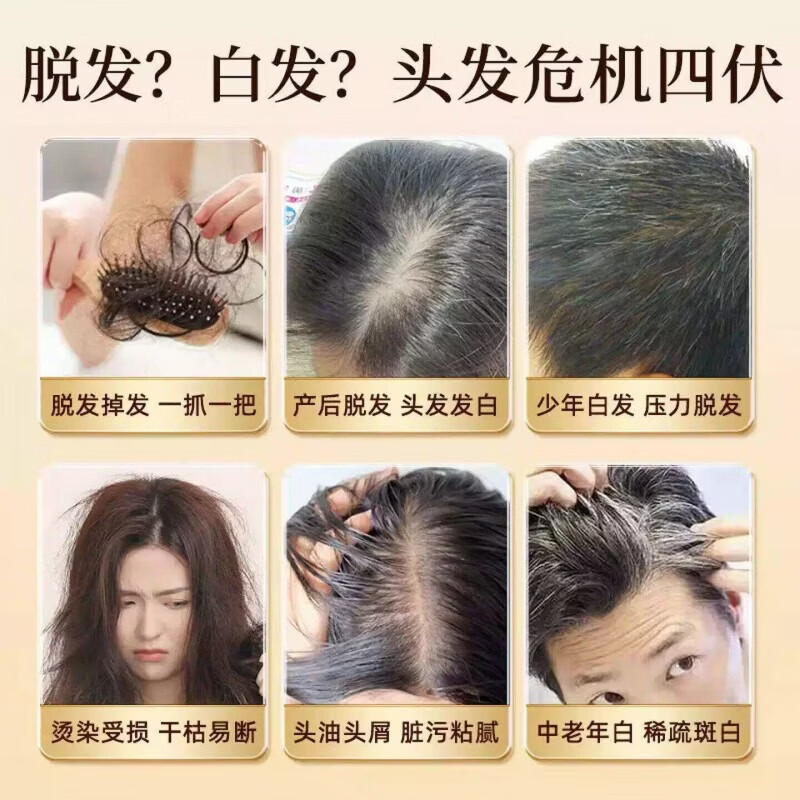 通用卡西奈维生素b片乌发素少中老年黑发改发质滋润毛发改善掉发脱发 巩固装【取代染发 乌黑靓丽】 42g*8盒 卡西奈维生素b黑发精华中老年白头变黑
