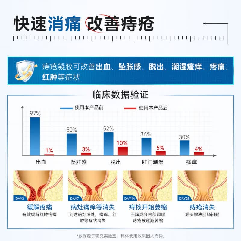 艾贝露痔疮凝胶医用卡波姆内外混合痔疮瘙痒大便出血肛裂疼痛正品 三盒装买二赠一【周期装】 【品质保障 谨防低价假货】