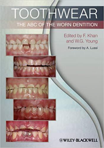 预订 toothwear - the abc of the worn dentition